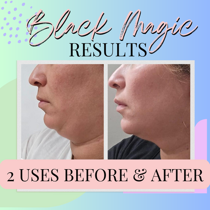 Black Magic comparison graphic with two side-profile photos of the jawline