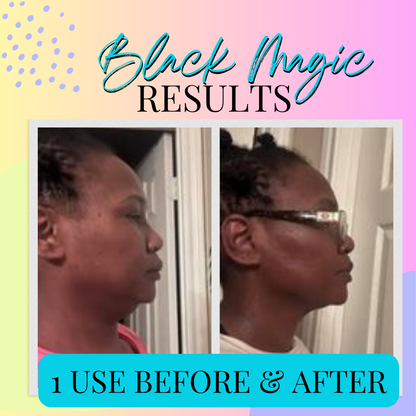 Black Magic comparison graphic with two side-profile photos of the chin and jawline