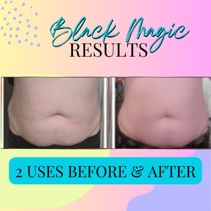 Black Magic comparison graphic with two front-view photos of the abdomen