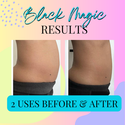 Black Magic comparison graphic with two side-view photos of the abdomen