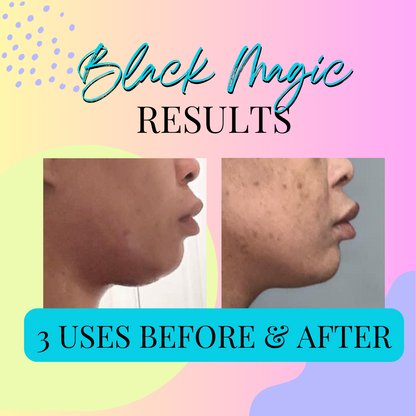 Black Magic comparison graphic with two side-profile photos of the chin